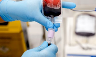 Fhemeron faz apelo por doações de sangue em Porto Velho: estoques críticos colocam vidas em risco