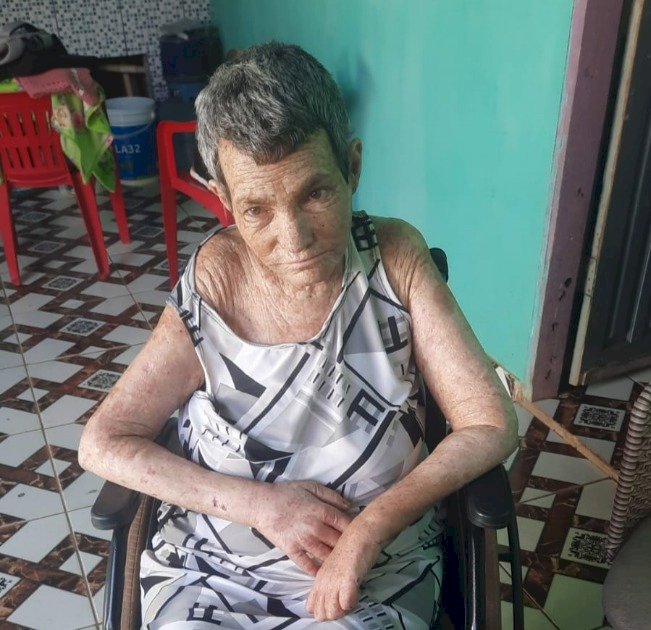 Moradora pioneira de Cerejeiras precisa de ajuda para custear tratamento após AVC e complicações de saúde