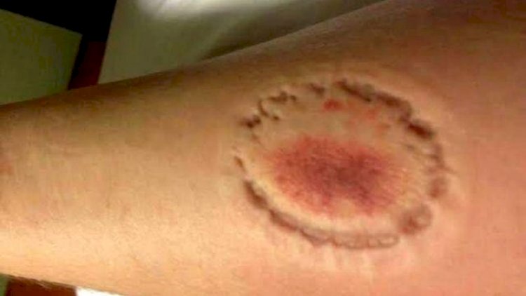Apenado com tornozeleira desligada morde policial e ameaça agentes durante abordagem em Vilhena
